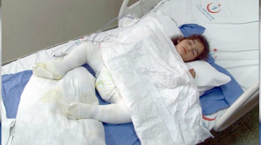 Oyun oynayan çocuk yanan tandıra düştü