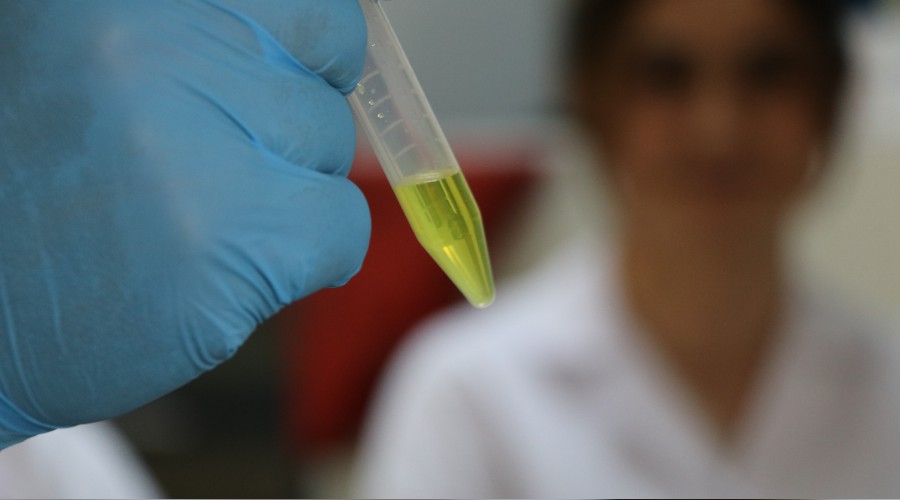 Virüsü engelleyen etken maddesi geliştirildi