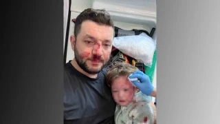 Yalova'da bebeğin yaralandığı komşu kavgası güvenlik kamerasına yansıdı