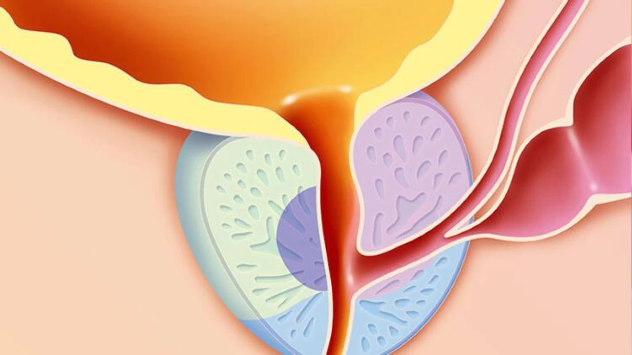 40'lı yaşlardan sonra prostat büyümesine dikkat!