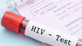 Erkek sünneti, HIV enfeksiyonuna karşı koruyor