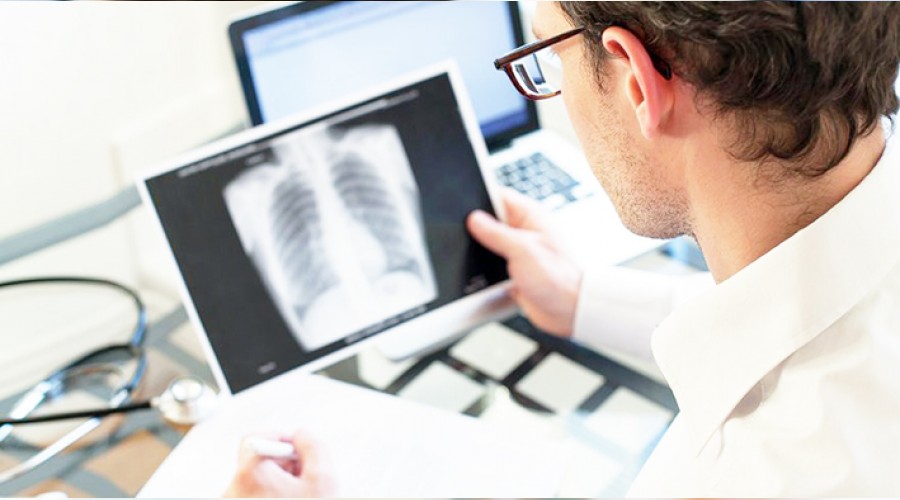 Verem 2017'de 1.3 milyon can aldı