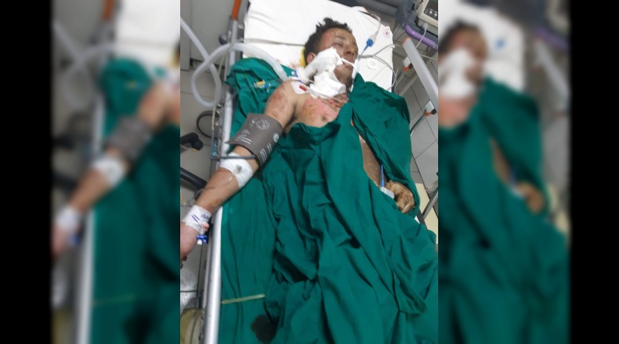 Elektriğe kapılan genç yoğun bakımda