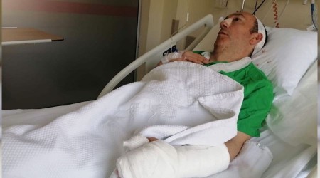 Tokat'ta 'gürültü' kavgasında profesör hastanelik oldu