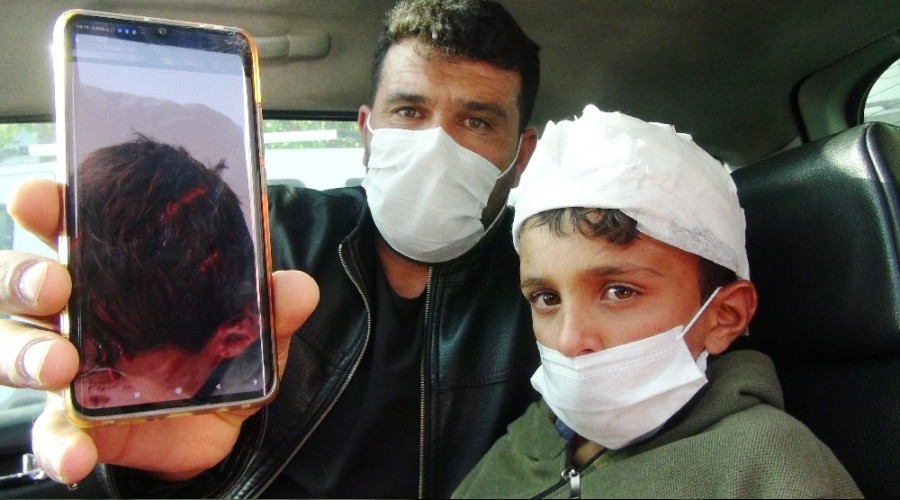 10 yaşındaki çocuğa öldüresiye dayak