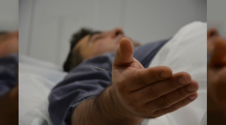 Akupunktur ile sağlıklı bir ömür