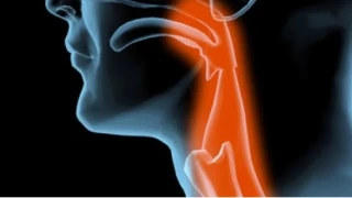 Geniz eti horlamadan daha fazlasına yol açıyor