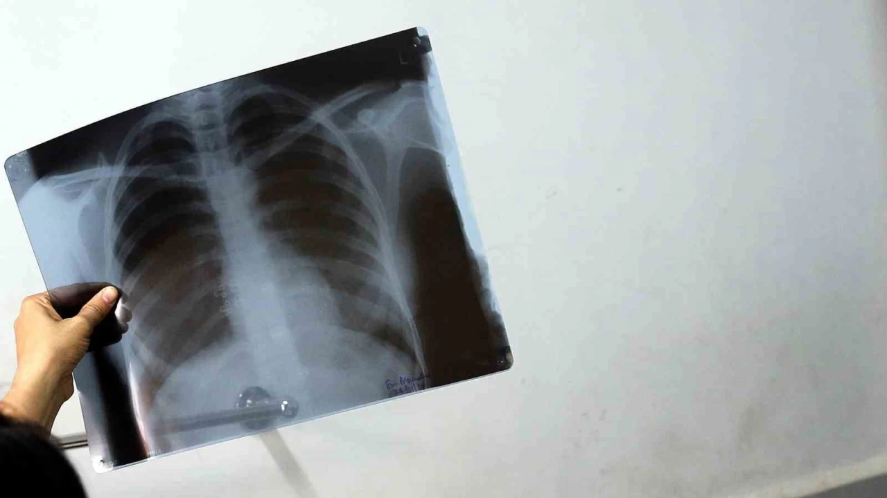 Bel ağrılarınız iltihaplı romatizma olabilir