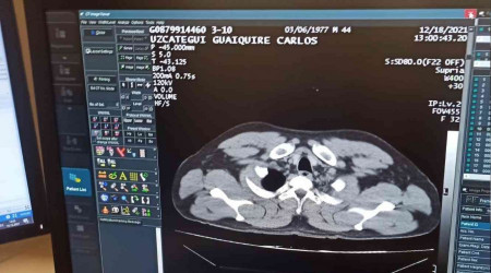 İstanbul Havalimanı'nda uyuşturucu kuryesi yakalandı