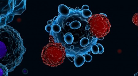 Lenfomada erken teşhis hayat kurtarıyor