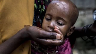 Sudan'daki kolera salgınında ölenlerin sayısı 252'ye çıktı