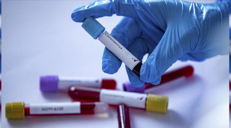 Tokyo'da vaka sayısı yükseliyor