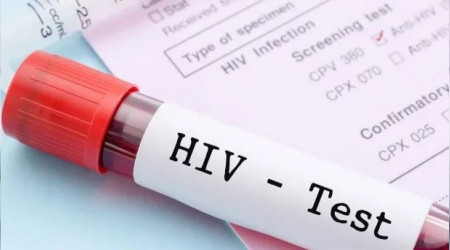 1.5 milyon yeni HIV vakas dnyay tehdit ediyor