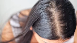 Biberiye saç dökülmesine karşı doğal bir çözüm mü?