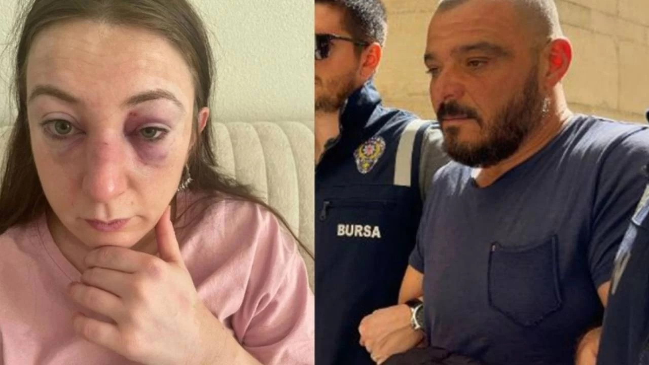 Eski kız arkadaşını kafa atan sanık 14 yıla kadar hapisle yargılanacak