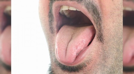 Geçmeyen ağız kokusunu çok önemseyin