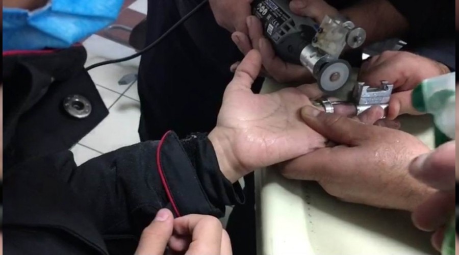 İtfaiyeden yüzük operasyonu