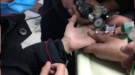 İtfaiyeden yüzük operasyonu