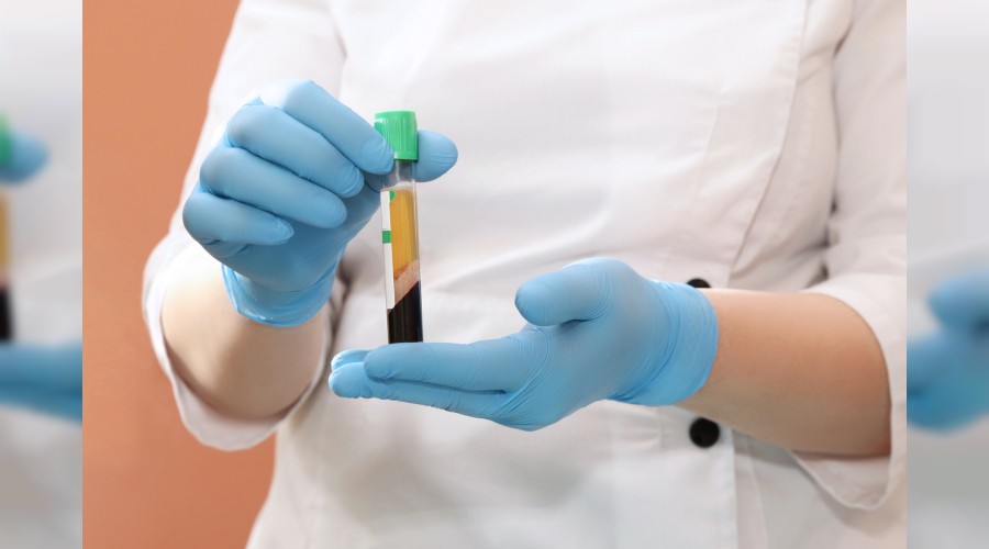 ‘Kendi kanınızla gençleşin’