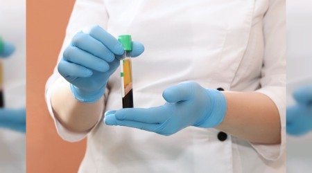 ‘Kendi kanınızla gençleşin’