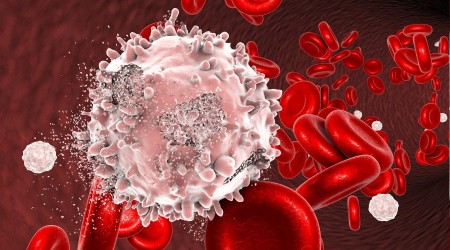 Lösemide sağ kalım oranı arttı