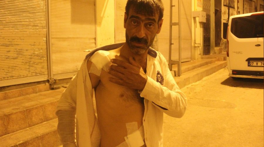 Damda çay içerken saçmaların hedefi oldu