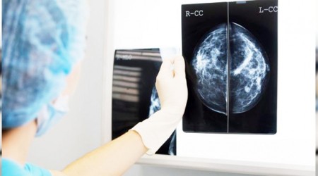 Yapay zeka doktorların pabucunu dama attı