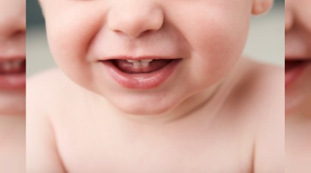 Bebeklerin diş sağlığını ihmal etmeyin