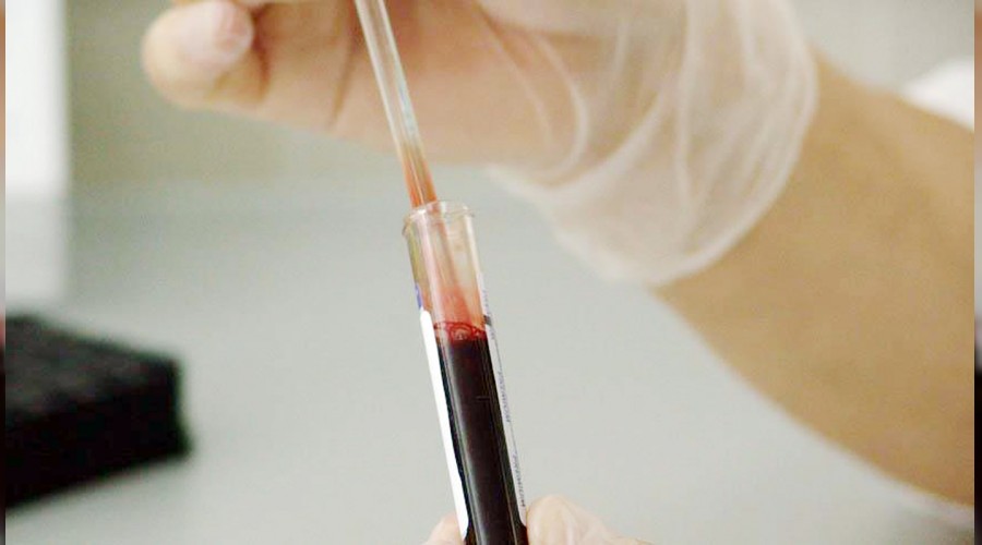 Çocuklarımız kanser oluyor