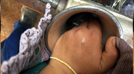 Elini kıyma makinesine kaptırdı