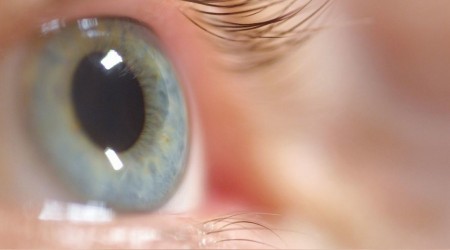 Glokom: Sinsi ve tehlikeli