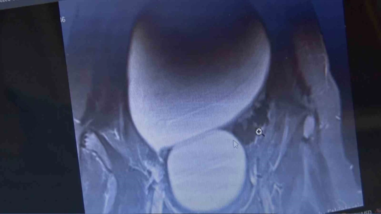 Doktorlar bile gözlerine inanamadı