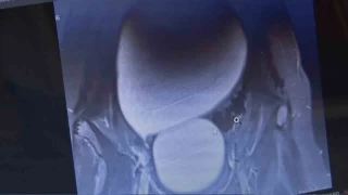 Doktorlar bile gözlerine inanamadı