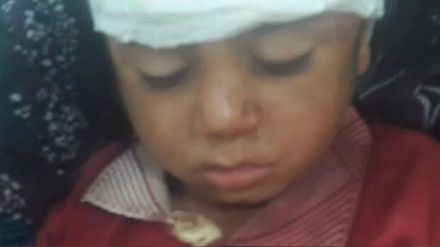 Şanlıurfa'da atın teptiği çocuk yaralandı