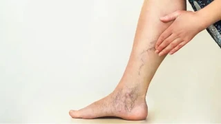 Varis, yalnızca estetik bir sorun değil