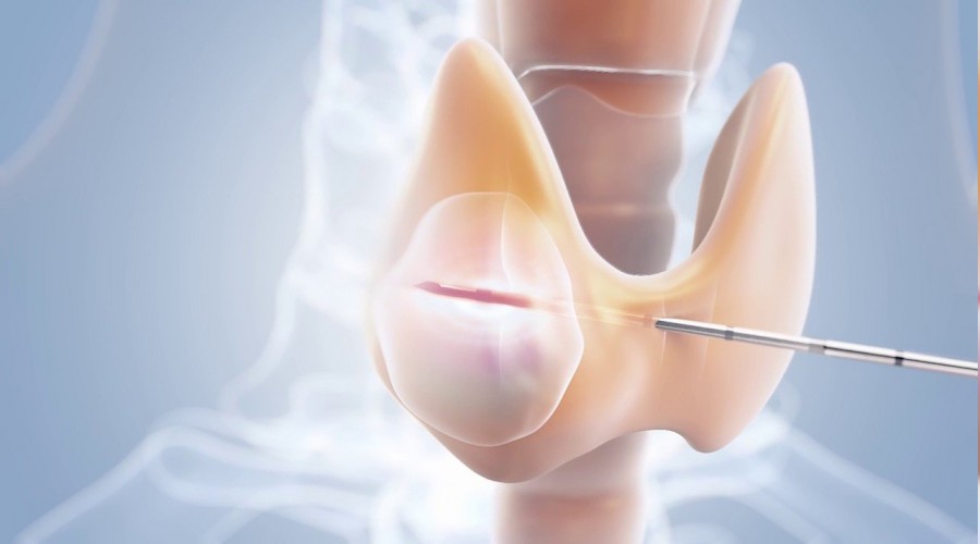 ‘Hipotroidi yetişkinlerde sık görülüyor’