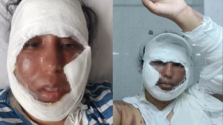 Sakarya'da gelin görümce tartışması hastanede son buldu