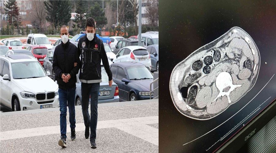 Yarım kilo eroini midesine saklamış
