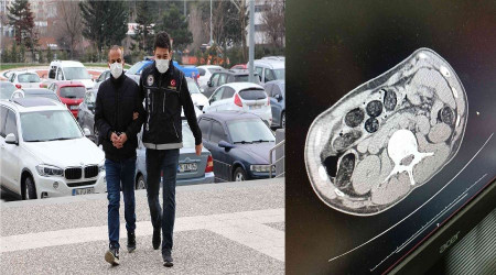 Yarım kilo eroini midesine saklamış
