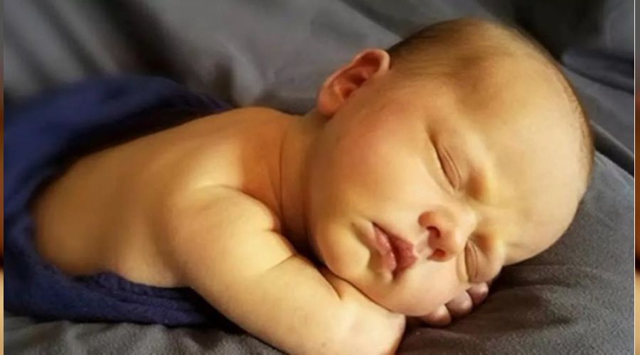 Yenidoğan sarılığı doğru bir şekilde tedavi edilmeli