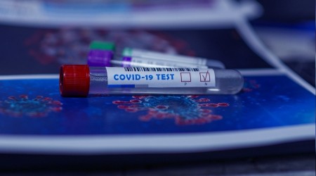 Gençlerde koronavirüs vakaları artıyor