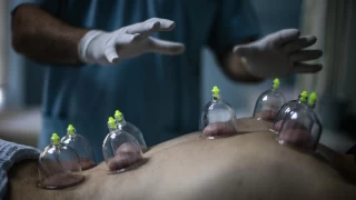 Hacamat geleneksel bir şifa yöntemi