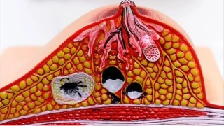 Kötü kolesterole sıkı takip şart