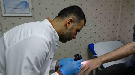 'Uyuz hastalığı Kovid-19 ile tetiklendi'