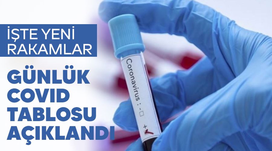7 bin 112 kişinin Kovid-19 testi pozitif çıktı, 129 kişi vefat etti