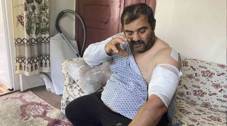 Ayı saldırısına uğrayan vatandaş: 'Beni öldü zannetti'