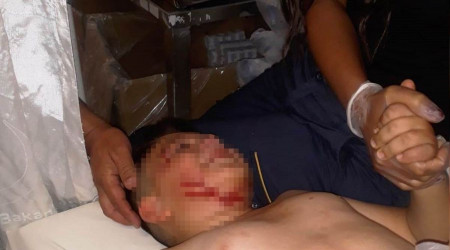 Konya'da köpeğin saldırdığı çocuk hastanelik oldu