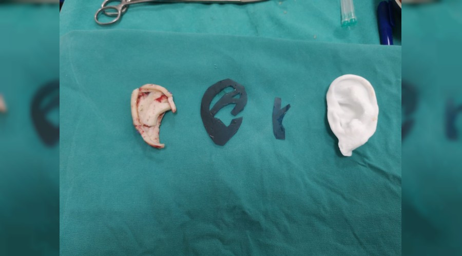 Kulaksızlık kaderiniz değil