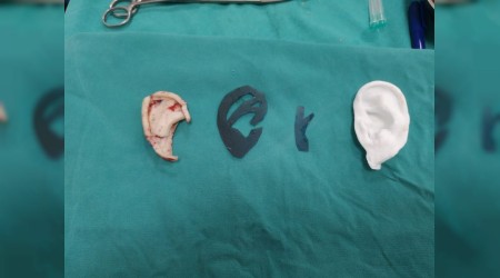 Kulaksızlık kaderiniz değil