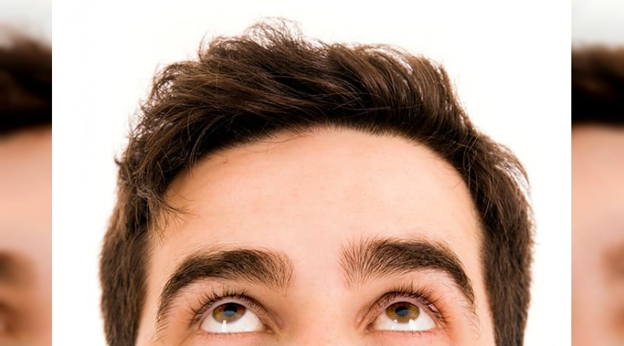 Saç ekiminden sonrası çok önemli